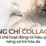 Căng chỉ collagen: cơ chế hoạt động và hiệu quả nâng cơ trẻ hóa da