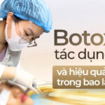 Botox có tác dụng gì và hiệu quả duy trì trong bao lâu?