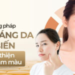 Các phương pháp làm sáng da phổ biến giúp cải thiện làn da sạm màu
