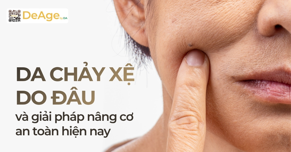 Thumb da chảy xệ