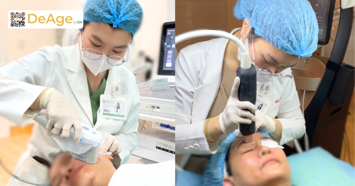 Nguyên nhân da sần sùi và cách cải thiện để làn da mịn màng hơn 12 Ultherapy Prime (bên trái) và RF Density (bên phải)