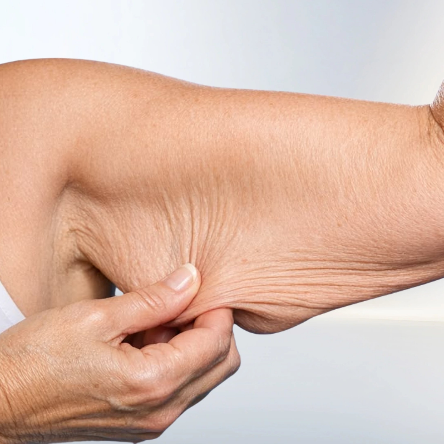 Ultherapy Prime 18