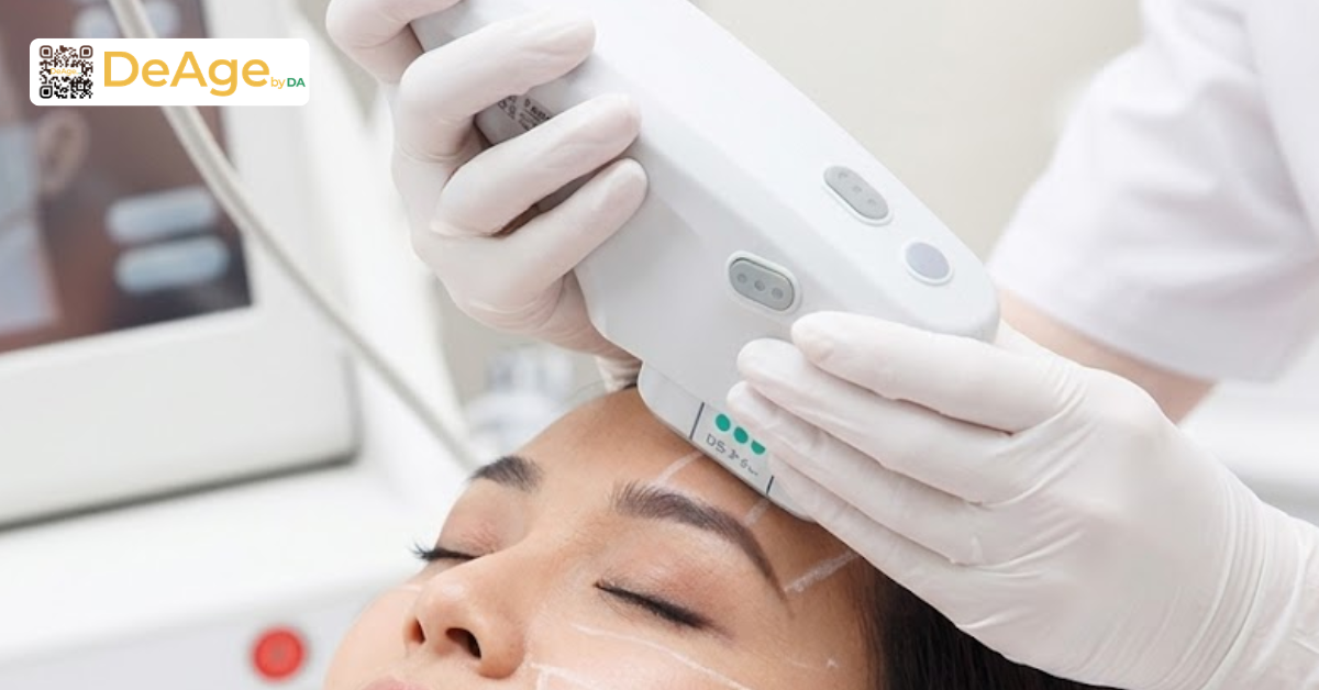 Nâng cơ mí mắt: bí quyết giúp vùng mắt trẻ trung và tươi tắn hơn 13 thực hiện ultherapy vùng mắt