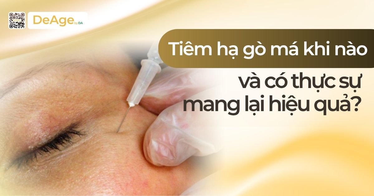 thumb Tiêm hạ gò má khi nào và có thực sự mang lại hiệu quả?