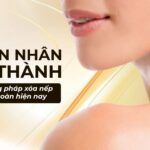 Nguyên nhân hình thành và các phương pháp xóa nếp nhăn cổ an toàn hiện nay