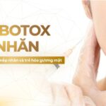 Tiêm botox xóa nhăn: giải pháp cải thiện nếp nhăn và trẻ hóa gương mặt
