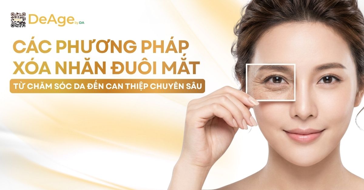 thumb Các phương pháp xóa nhăn đuôi mắt từ chăm sóc da đến can thiệp chuyên sâu