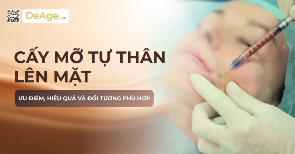 thumb Cấy mỡ tự thân lên mặt_ Ưu điểm, hiệu quả và đối tượng phù hợp