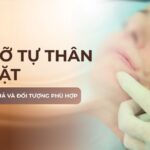 Cấy mỡ tự thân lên mặt: ưu điểm, hiệu quả và đối tượng phù hợp