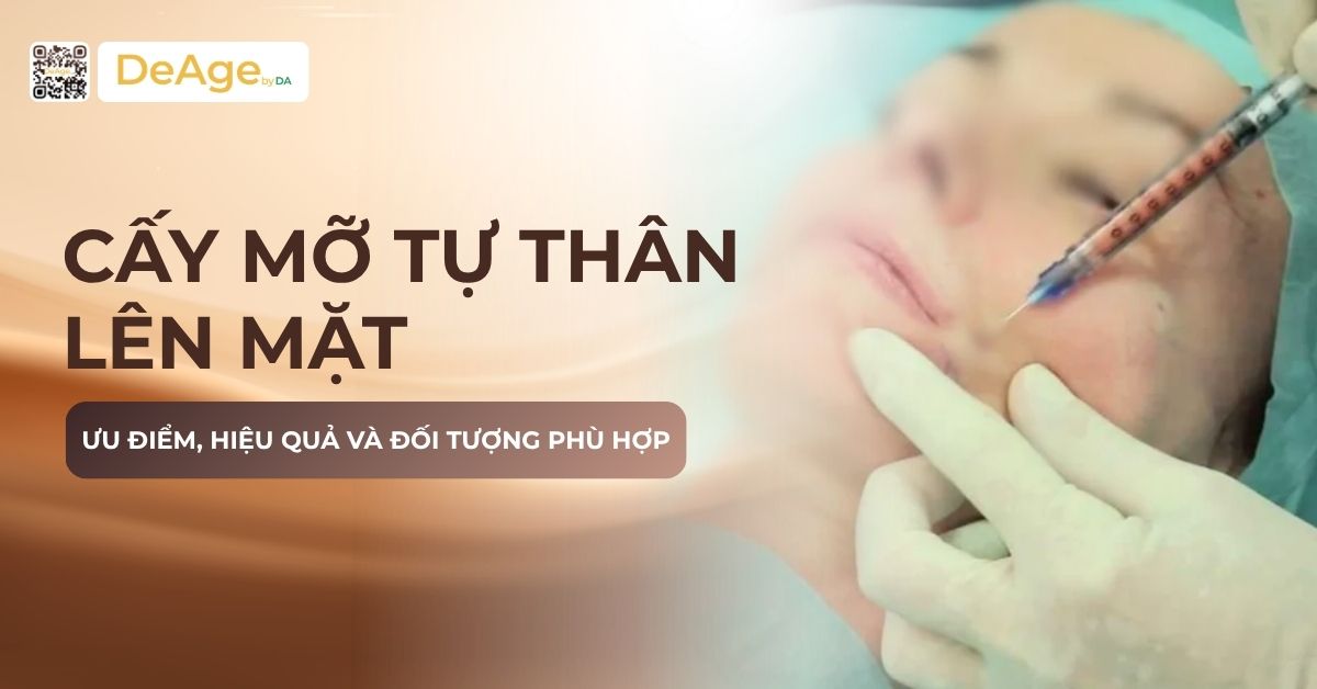 thumb Cấy mỡ tự thân lên mặt_ Ưu điểm, hiệu quả và đối tượng phù hợp