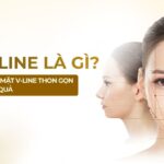 Mặt V-line là gì? Cách tạo gương mặt V-line thon gọn an toàn và hiệu quả
