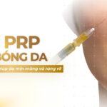 Tiêm PRP căng bóng da: giải pháp trẻ hóa giúp da mịn màng và rạng rỡ