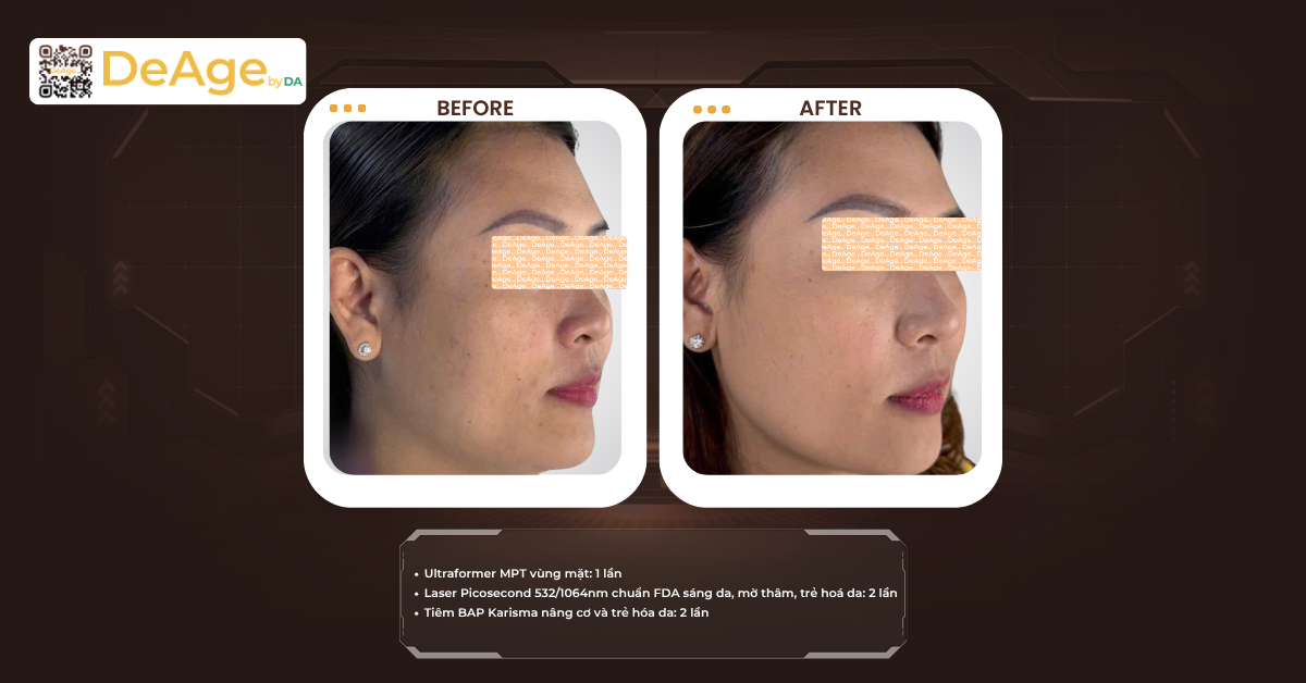 Hướng dẫn massage căng da mặt giúp da săn chắc và tươi tắn hơn 12 CLS