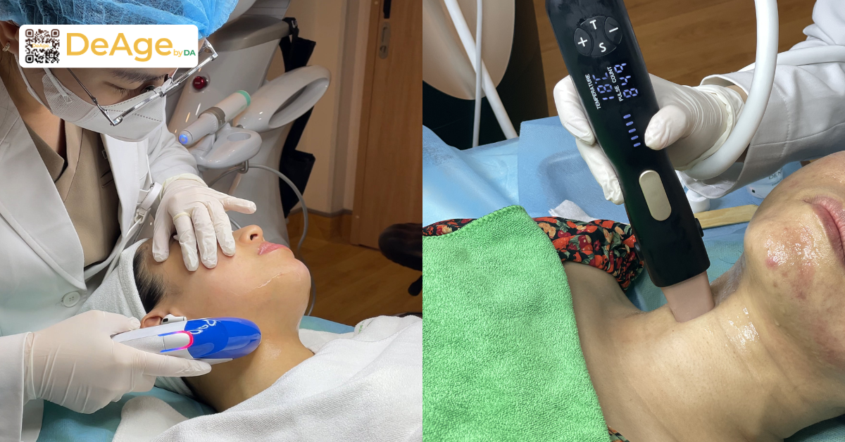 Da cổ sần sùi do đâu và cách giúp da cổ mịn màng hơn 8 Công nghệ cao HIFU và RF