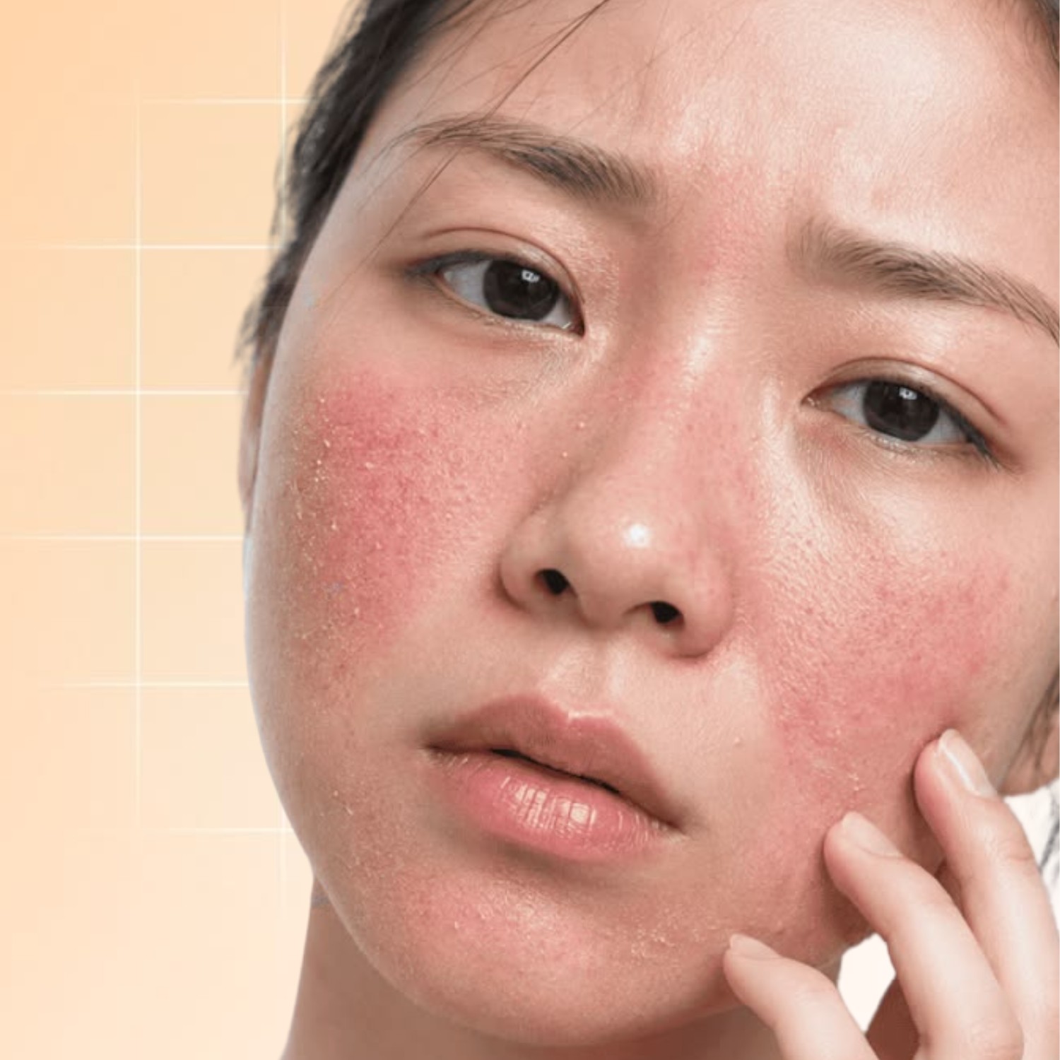 Da khô thiếu ẩm và kém sức sống