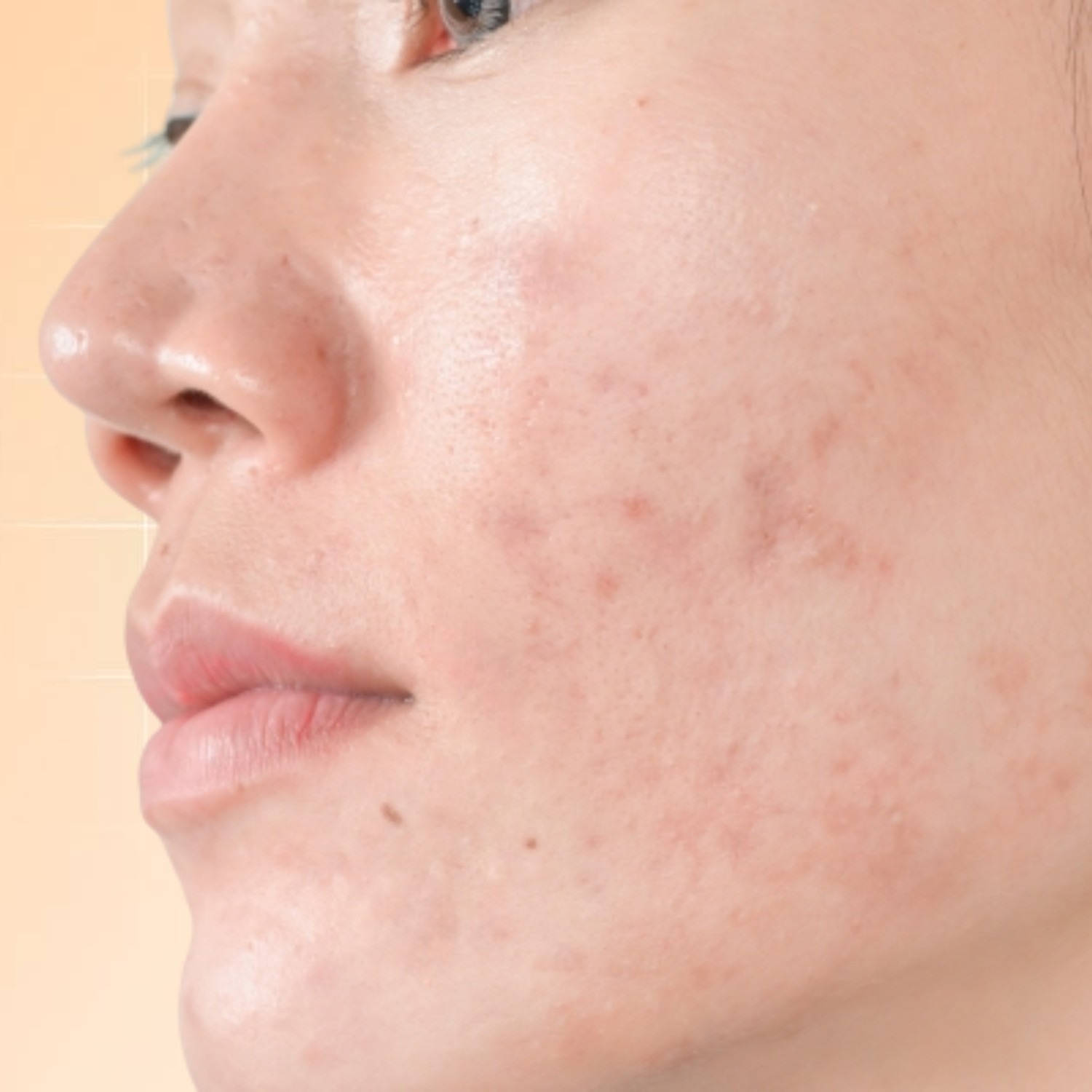 Da xỉn màu không đều màu