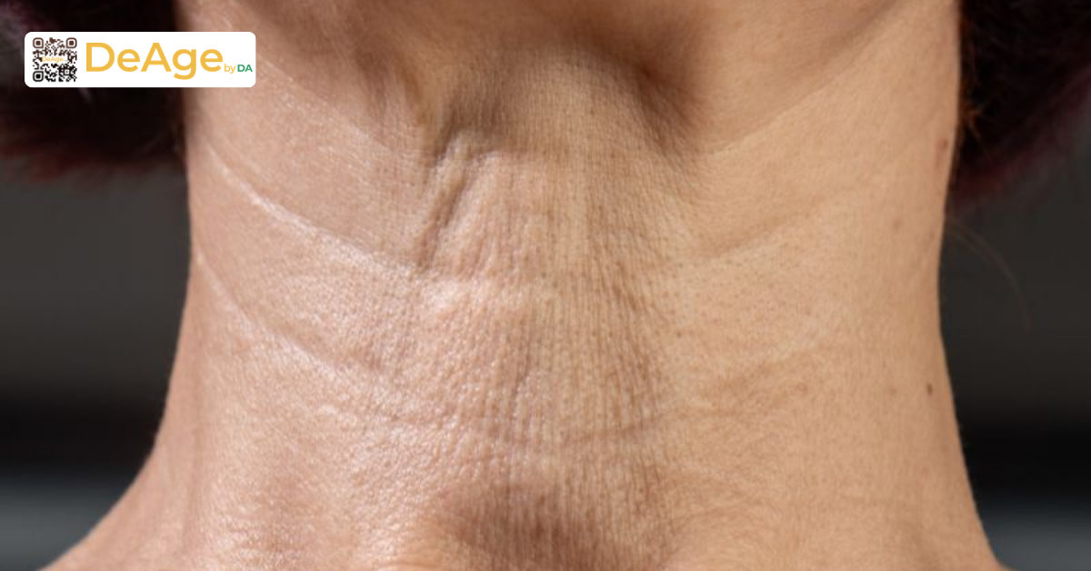 Da cổ sần sùi do đâu và cách giúp da cổ mịn màng hơn 1 Dấu hiệu nhận biết da cổ sần sùi và lão hóa vùng cổ