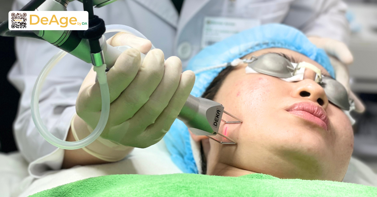 Laser tái tạo bề mặt