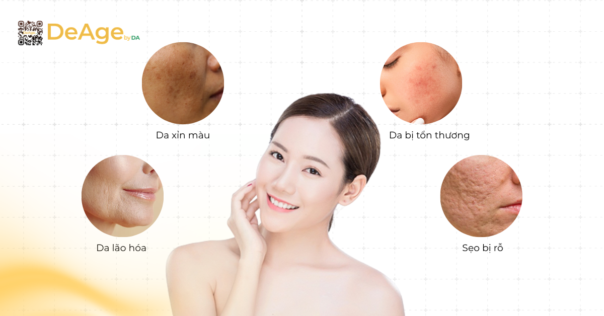 Tiêm PRP căng bóng da: giải pháp trẻ hóa giúp da mịn màng và rạng rỡ 3 PRP căng bóng da mang lại hiệu quả gì