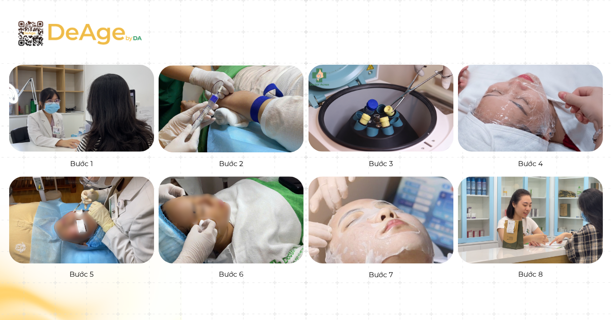 Tiêm PRP căng bóng da: giải pháp trẻ hóa giúp da mịn màng và rạng rỡ 10 Quy trình tiêm PRP căng bóng da chuẩn y khoa tại DeAge by DA