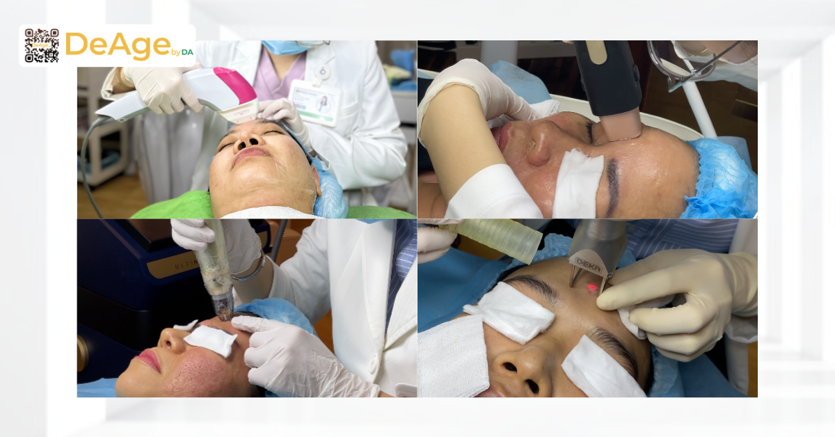 Xóa nhăn ấn đường: bí quyết giúp gương mặt hiền hòa, bớt cau có 9 Một số công nghệ sử dụng năng lượng được ứng dụng trong điều trị nếp nhăn ấn đường
