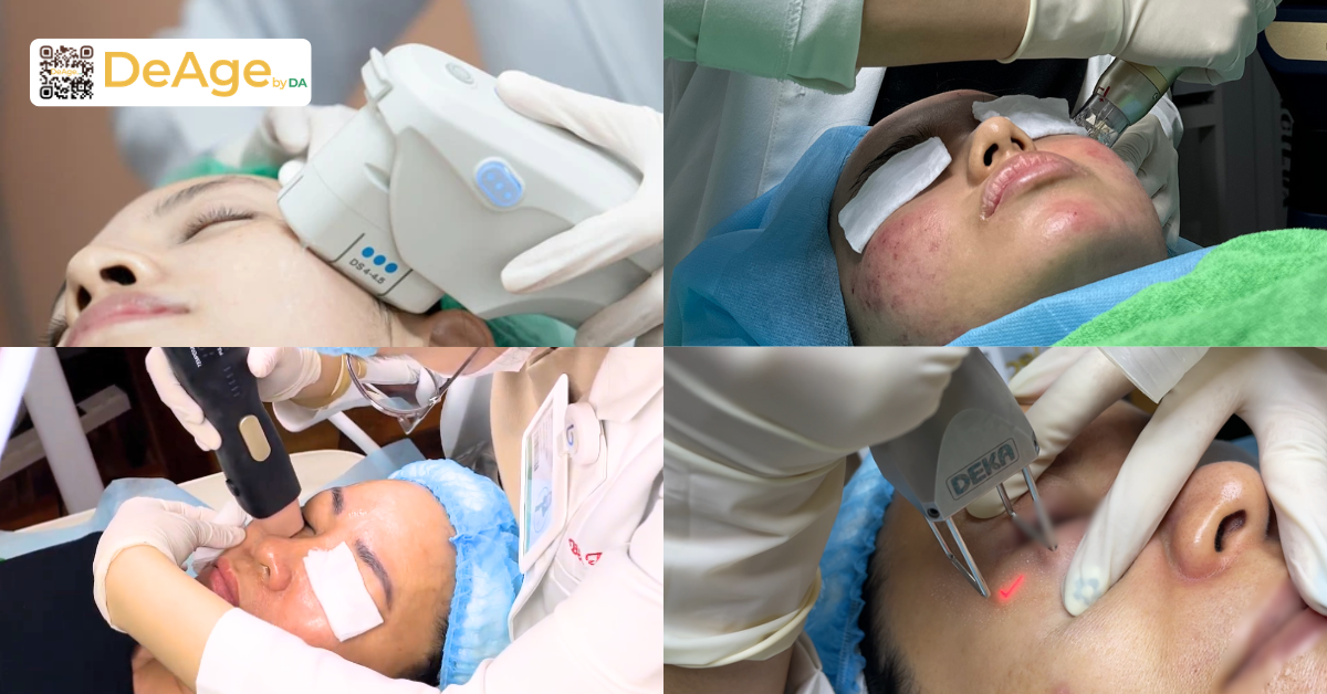 7 phương pháp xóa vết chân chim hiệu quả nhất: cách nào phù hợp với bạn? 8 Sử dụng công nghệ năng lượng mắt