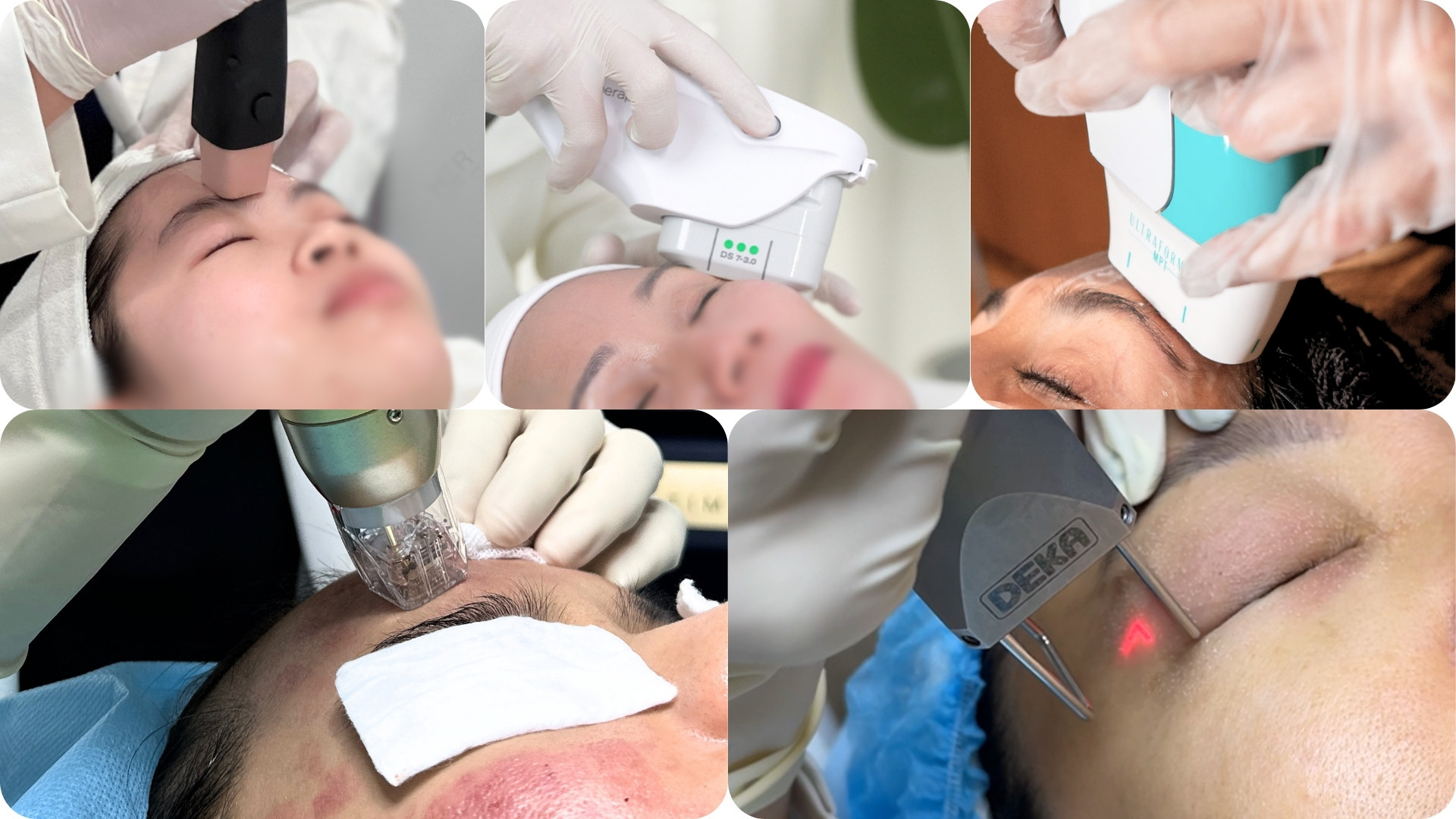 Tái cấu trúc nền da và tăng sinh collagen