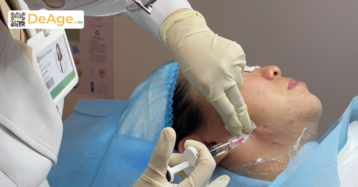 Tiêm trẻ hóa da: giải pháp cải thiện dấu hiệu lão hóa từ bên trong 2 Tiêm trẻ hóa da là gì (1)