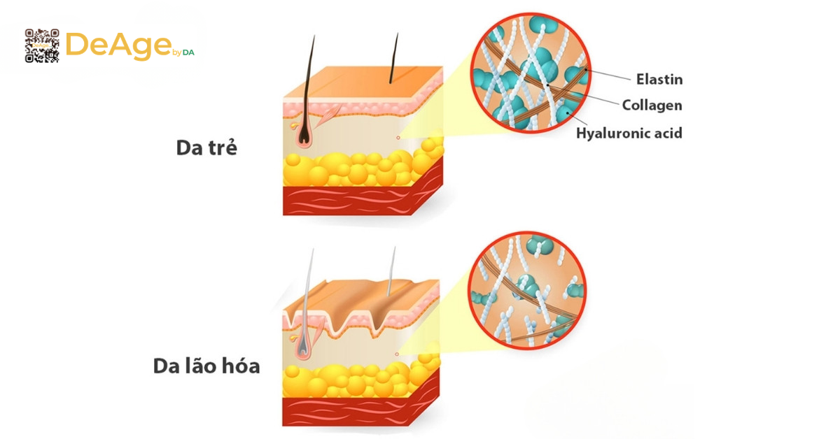 7 phương pháp xóa vết chân chim hiệu quả nhất: cách nào phù hợp với bạn? 3 suy giảm collagen và elastin