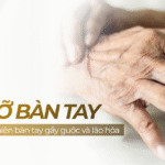 Cấy mỡ bàn tay: giải pháp cải thiện bàn tay gầy guộc và lão hóa
