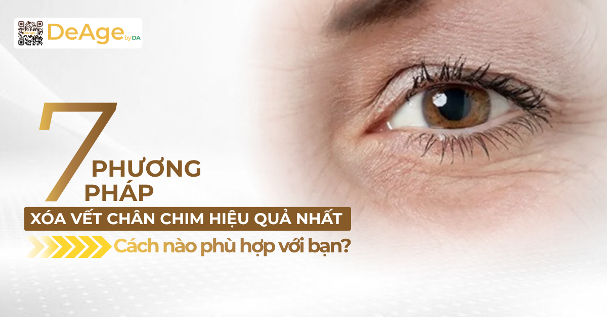 thumb 7 phương pháp xóa vết chân chim hiệu quả nhất cách nào phù hợp với bạn