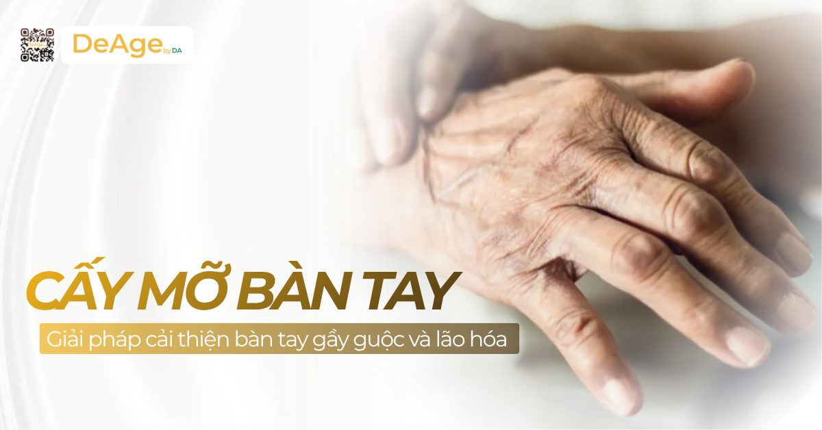 thumb Cấy mỡ bàn tay: Giải pháp cải thiện bàn tay gầy guộc và lão hóa