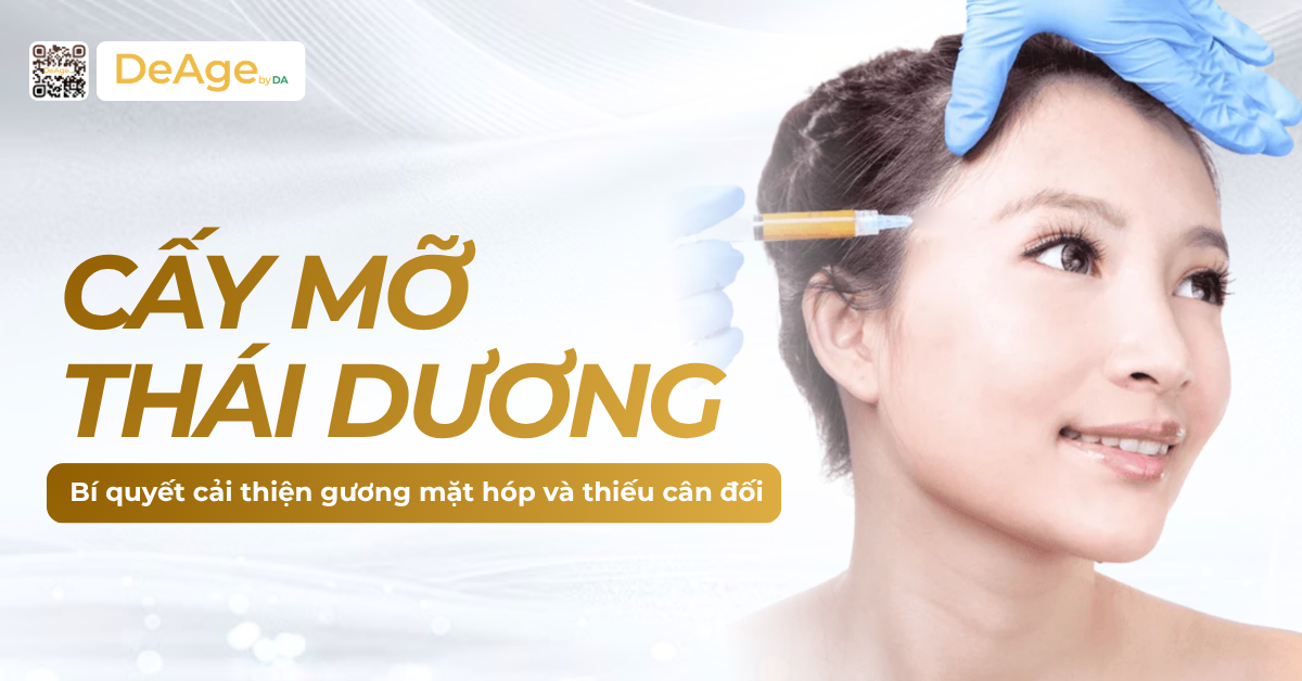 thumb Cấy mỡ thái dương bí quyết cải thiện gương mặt hóp và thiếu cân đối