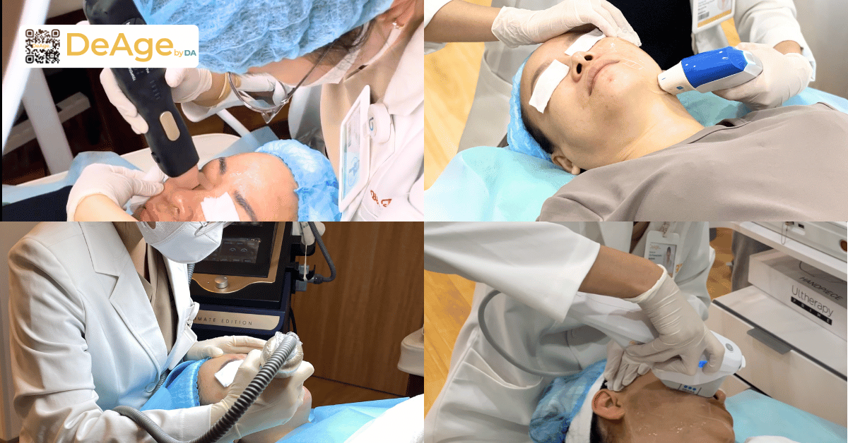 Cách làm cằm thon gọn có khó như bạn nghĩ? Bật mí 8 phương pháp phổ biến hiện nay 8 Cách làm cằm thon gọn có khó như bạn nghĩ Bật mí 8 phương pháp phổ biến hiện nay (1) (1)
