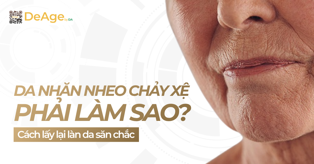 Da nhăn nheo chảy xệ