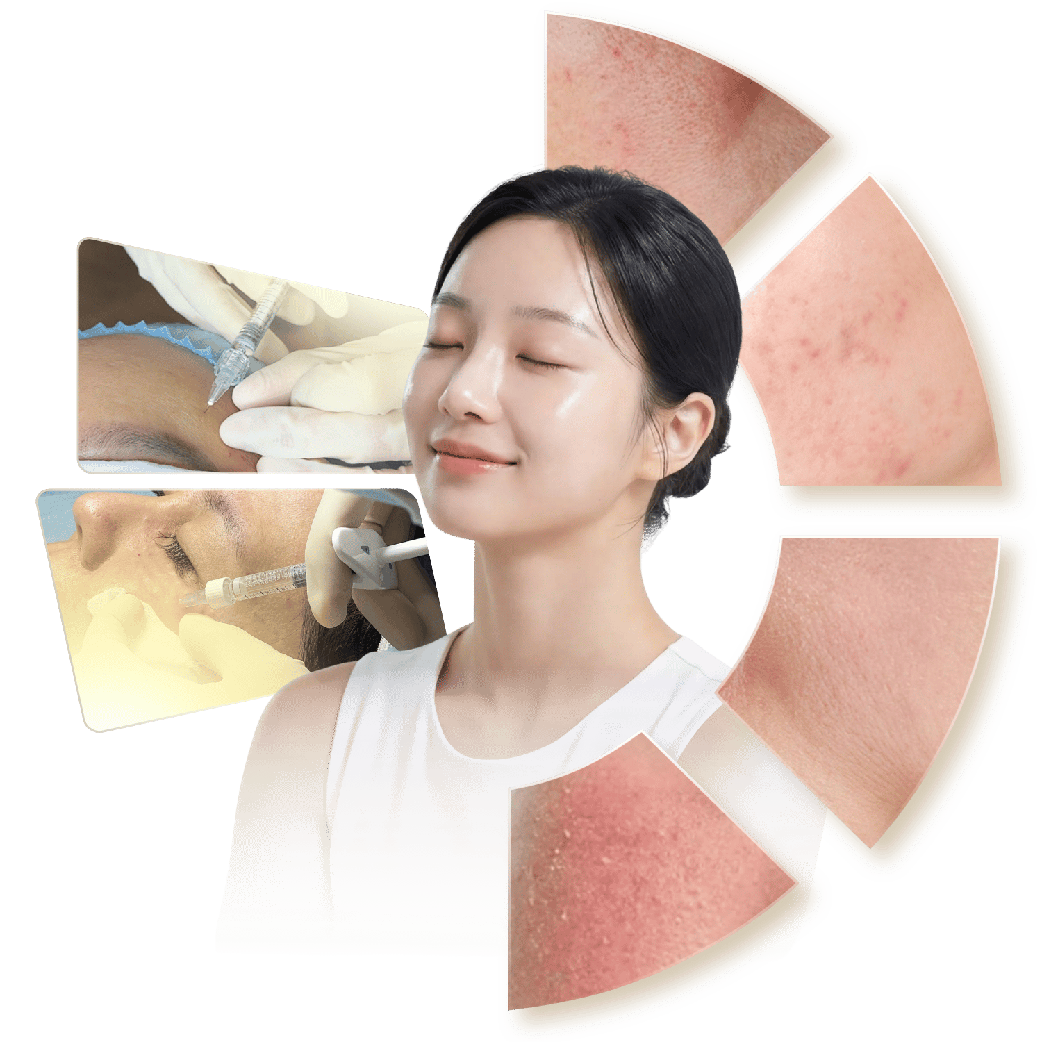 Mesotherapy mang lại hiệu quả gì
