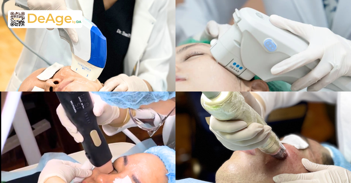 Căng da mặt cho nam: giải pháp cải thiện da chùng nhão và nếp nhăn tuổi tác 4 Nhóm công nghệ nâng cơ
