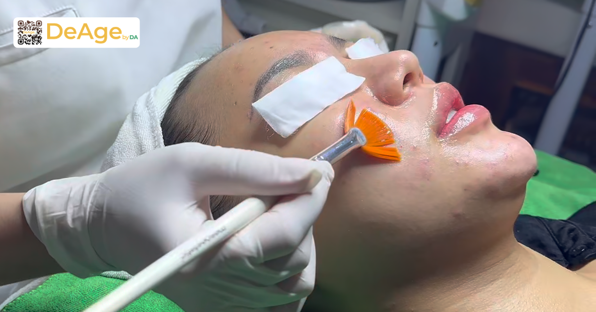 7 cách làm da căng bóng, mịn màng chuẩn xu hướng Hàn Quốc 7 Peel da hóa học