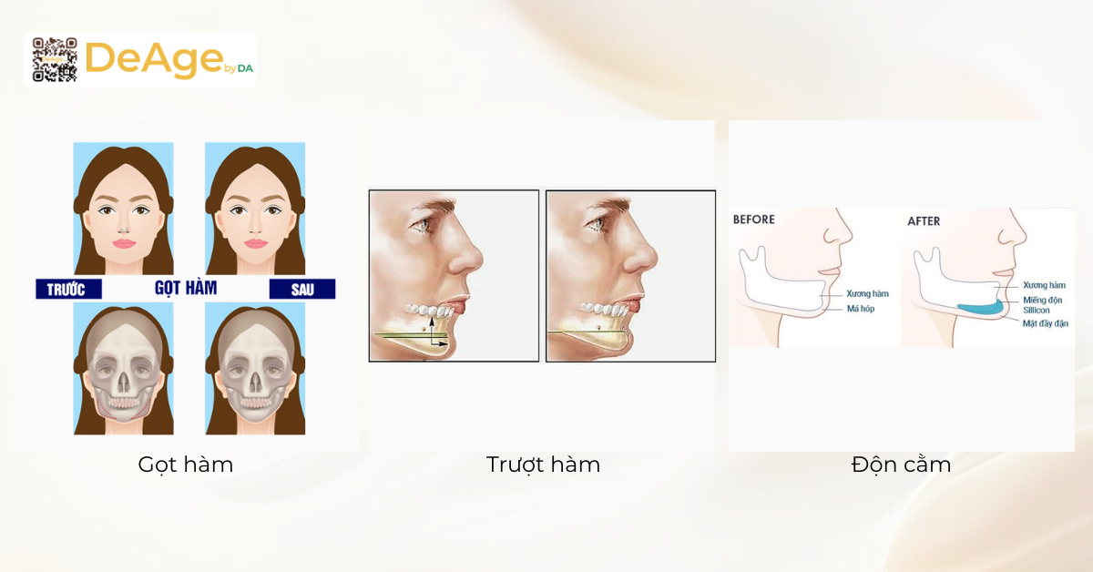 Phẫu thuật tạo hình khuôn mặt