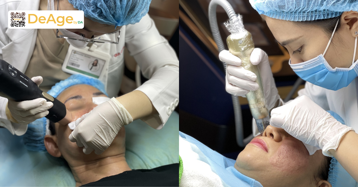 7 cách làm da căng bóng, mịn màng chuẩn xu hướng Hàn Quốc 8 Công nghệ RF, RF vi kim giúp hỗ trợ làm săn chắc và cải thiện các dấu hiệu lão hóa da tại DeAge by DA