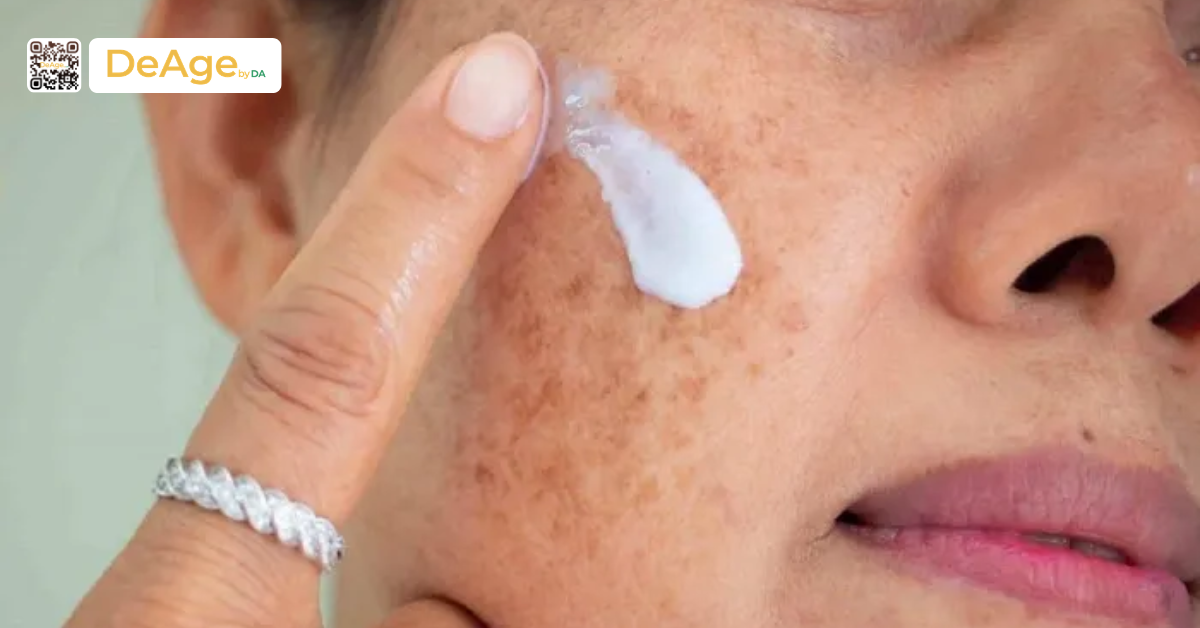 Tìm hiểu cấu trúc da nám: chìa khóa để lựa chọn phương pháp xử lý phù hợp 6 Sử dụng các hoạt chất ức chế và phục hồi cấu trúc da