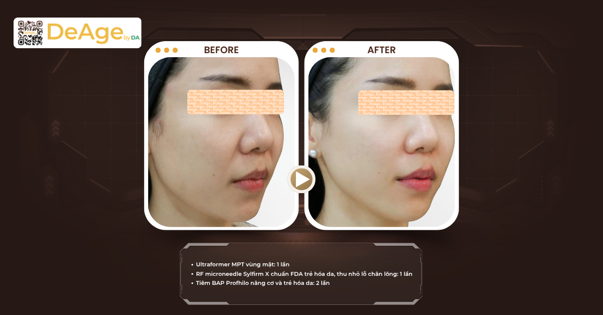 7 cách làm da căng bóng, mịn màng chuẩn xu hướng Hàn Quốc 9 cls hifu
