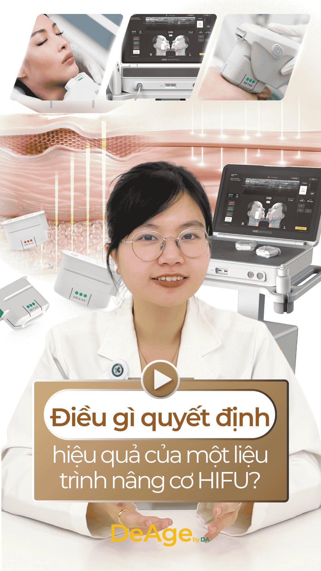 Ultherapy Prime 32