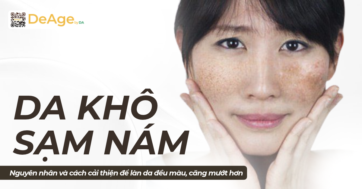 thumb Da khô sạm nám: Nguyên nhân và cách cải thiện để làn da đều màu, căng mướt hơn