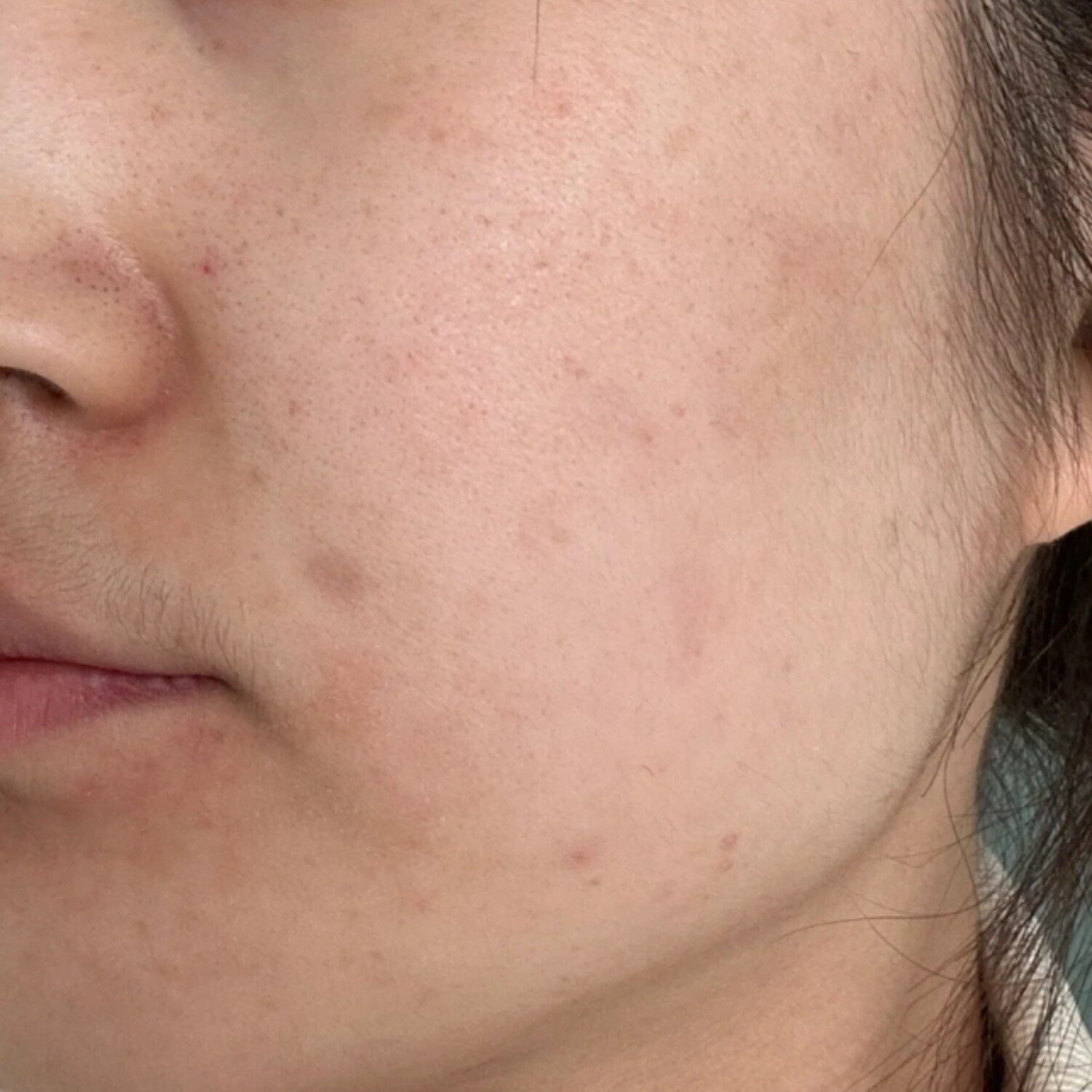 Da không đều màu