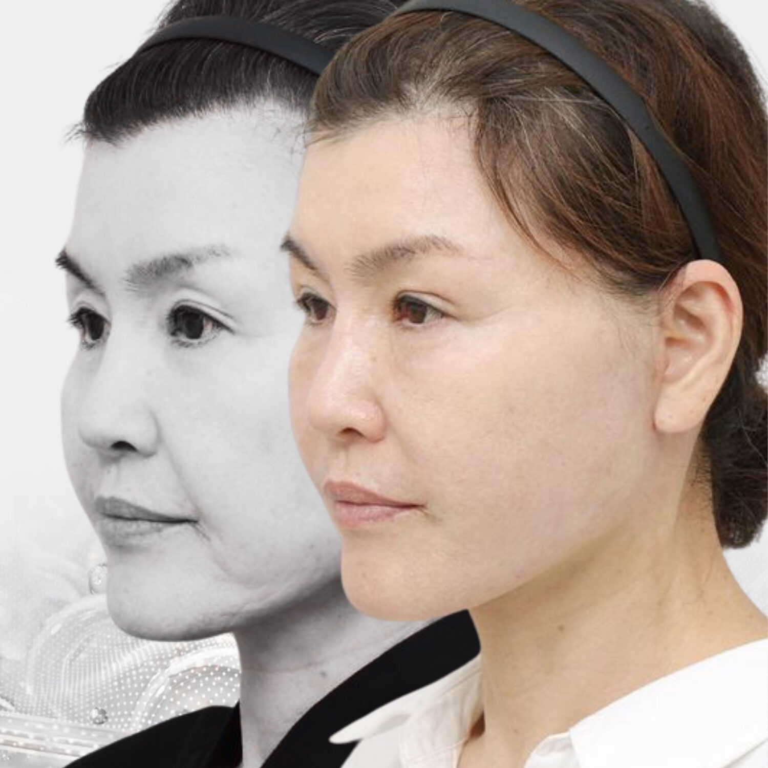 Giúp gương mặt trông thon gọn hơn