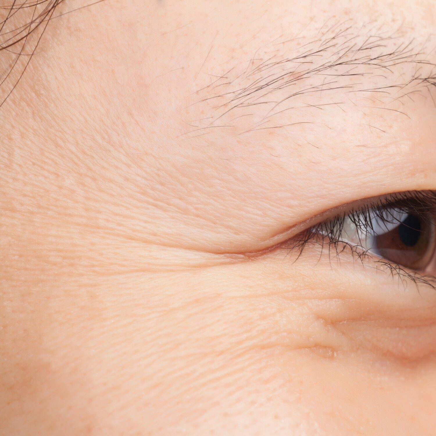 Nếp nhăn nhỏ quanh mắt miệng trán