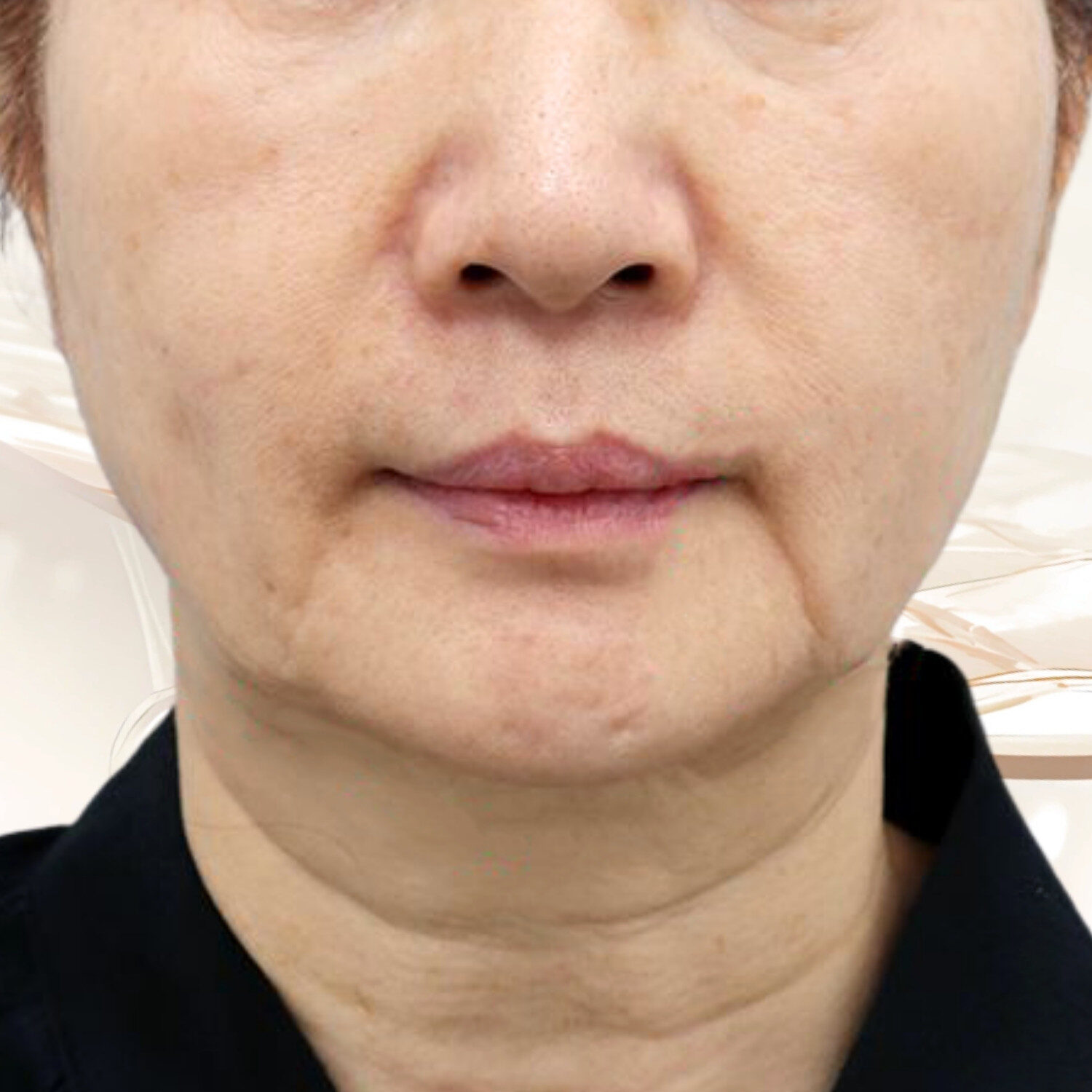 Người mong muốn giải quyết dấu hiệu lão hóa sâu
