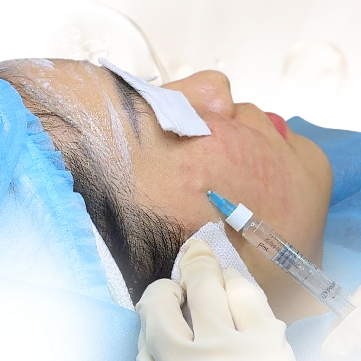 Tiêm hoạt chất kích thích sinh học